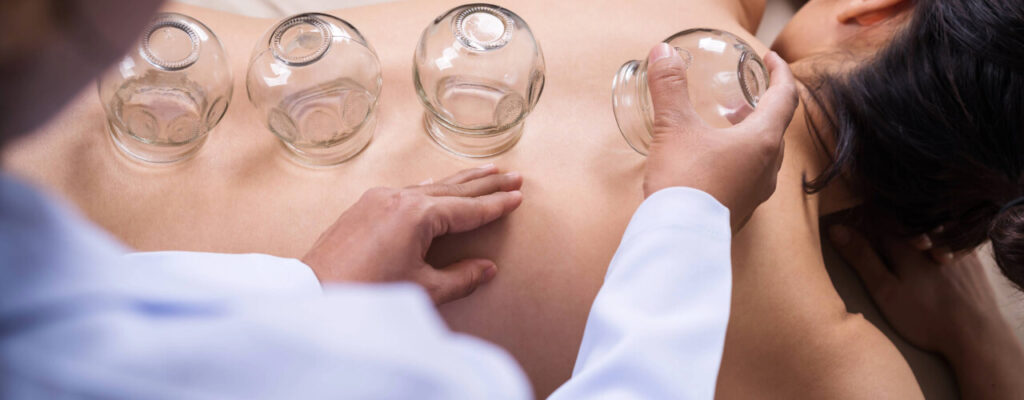 Find Neck Pain Relief with Cupping: A Physical Therapist's Approach