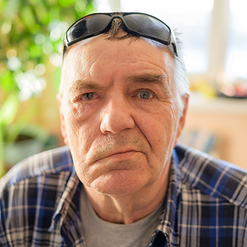 Why Optimum Physio Therapies Is the Right Choice for Addressing Bell’s Palsy