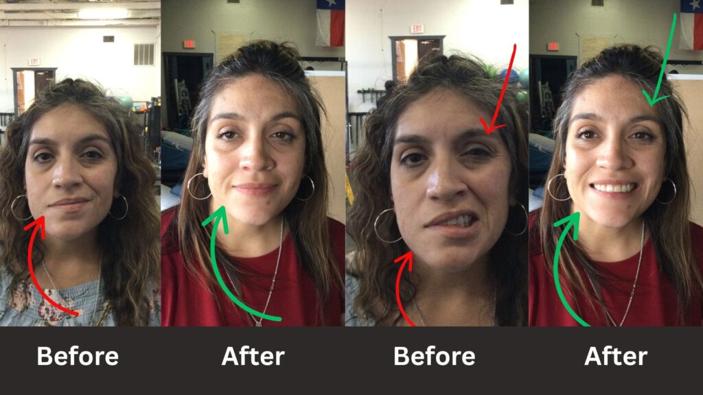 before and after Bells treatment 1